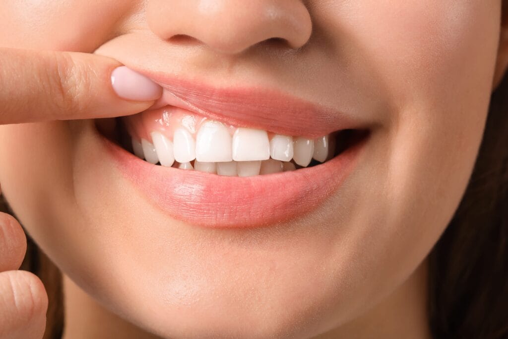 Gum care and oral hygiene maintenance for healthy teeth and gums