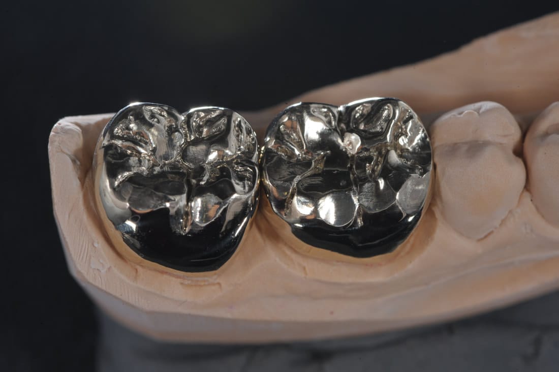 Metal dental crown used for molar tooth restoration