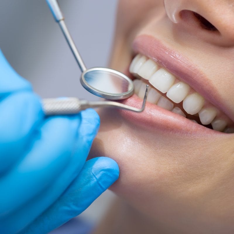 Dentist examining restored teeth after dental treatment