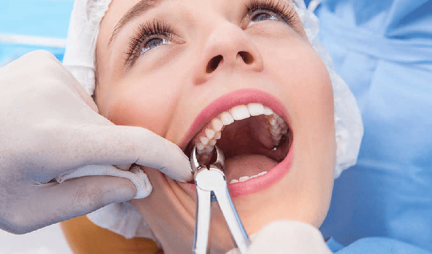 Simple tooth extraction planned with patient comfort in mind